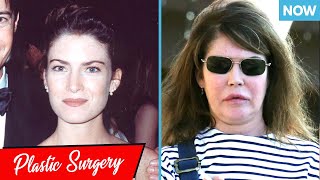 Worst Celebrity Plastic Surgery Disasters Then and Now