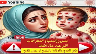 ⚠️ بحمرون رجع بقوة! أعراض خطيرة، مضاعفات مميتة، #وطرق الحماية الفعالة بالتلقيح او  بدون تلقيح