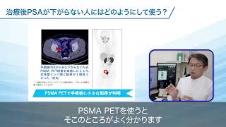 【第3回】『PSMA PETの応用』 - PSMAが変える前立腺がん診療