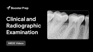 Endodontics | Clinical and Radiographic Examination | INBDE, NDEB, ADAT