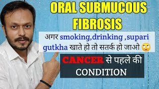 OSMF TREATMENT IN HINDI | ORAL SUBMUCOUS FIBROSIS TREATMENT in Hindi | IS OSMF IS CANCER ?😢