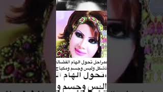 فنانات من دون ميك آب ولا هذه اشكالهم من دون تجميل !؟