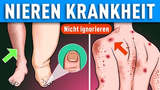 4 akute Anzeichen und Symptome einer Nierenerkrankung!