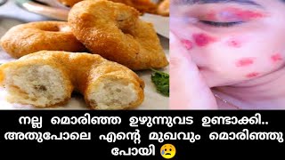 ചായ കടയിലെ നല്ല മൊരിഞ്ഞ ഉഴുന്നു വട ഇനി എളുപ്പത്തിൽ ഉണ്ടാക്കാം ഈ ഒരു ചേരുവ ചേർത്താൽ മതി😋