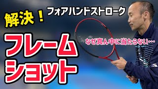 【テニス】さよならフレームショット！起きる症状の原因と解決法を紹介します！