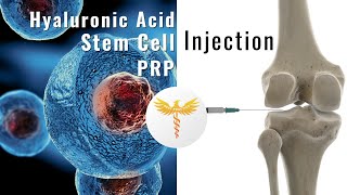 PRP, Stem cells, or hyaluronic acid injection to delay knee replacement surgery? | A new study