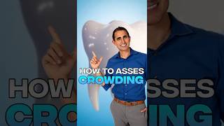 Crowding analysis in the mixed dentition #jawgrowth #facialgrowth #orthodontics #orthodontist