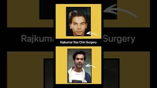 Rajkumar Rao | Before and After | Fat to Fit Body Transformation | Surgery