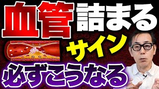 【死亡事例多数】なぜ報道しない？血管が詰まる直前の人にだけ出る“命の危険サイン“⚠️若い人もなるから絶対気をつけて！【脳梗塞 足切断 虚血性心疾患 狭心症】