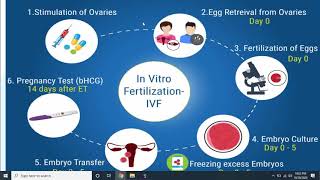In vitro fertilization (IVF) and embryo transfer