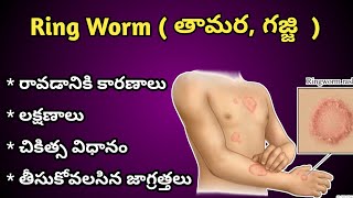 Ring Worm ( తామర, గజ్జి ) causes , Symptoms and Treatment in Telugu.