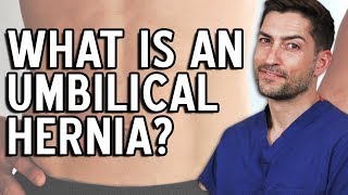 Umbilical Hernia - Everything You Need To Know!
