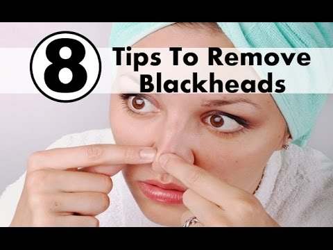 Home remedies to remove blackheads naturally at home Home remedies to remove blackheads naturally at home