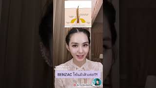 ⚠️ #Benzac ใช้เเล้ว #สิวเห่อ ควรหยุดมั๊ย ? #SKINCARE101 ep.6 | DOCTORDAYDREAMER