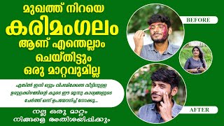 മുഖത്ത് നിറയെ കരിമംഗലം ആണ് എന്തെല്ലാം ചെയ്തിട്ടും ഒരു മാറ്റവുമില്ല