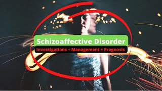 Schizoaffective Disorder | Investigations + Management + Prognosis