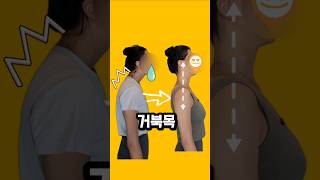 거북목 교정 12회만에 완성해요(실제 후기 포함)