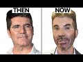 Simon Cowell NEW FACE | Plastic Surgery Analysis