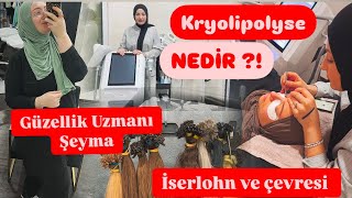 Bu alet BAMBAŞKA😍Buz yöntemi ile bölgesel yağ eritme⁉️tüm takipcilerime ÖZEL İNDİRİM😍Özge ile birgün