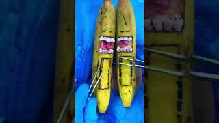 Twin bananas die in Surgery 😓🪦🤧💔🥺 #DiscountDentist Ep 238 #FruitSurgery #Shorts #SatisfyingASMR