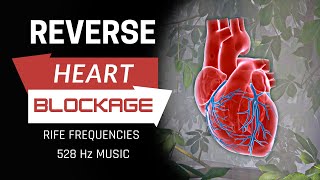 Heart Blockage Reversal | Remove Heart Blockage Naturally | RIFE Frequencies | 528 Hz Music #MF148