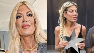 Ozempic RUINED These Celebs Faces (Leaked Before & After Photos)