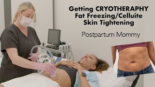 Getting CRYOTHERAPY on my Postpartum Tummy! Mary Scott Skincare | BiancaReneeToday