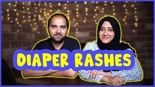 Prevent and Treat Diaper Rash | Simple Tips