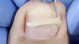 Make toenails healthy and beautiful【Xue Yidao Pedicure】