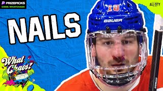 Zach Hyman is tough as nails, Nick Foligno \u0026 Taylor Hall join