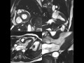 UCSF Radiology: The Multiple Planes of Cardiac MRI