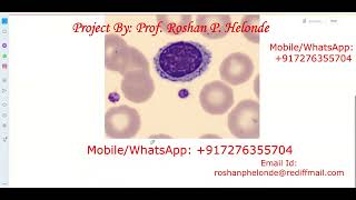 Blood Cell Classification Using CNN Python Source Code | Blood Cell Detection Using Neural Network