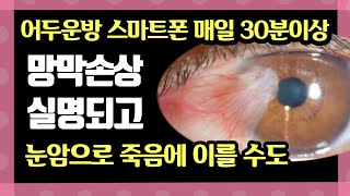 눈건강/눈건강해지는법/어두운방 매일 스마트폰보다가 죽음에 이른 40대 남자이야기