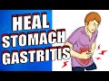 How To Heal Symptoms Of Inflammation of the Stomach Gastritis Naturally