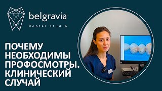 👩‍⚕️ Почему необходимы профосмотры у стоматолога? Клинический случай