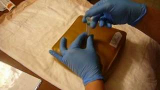 Administering an Intramuscular Injection