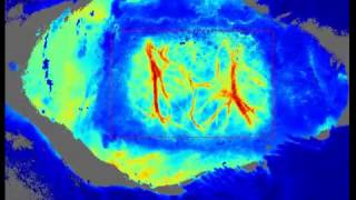 Moor laser speckle imaging