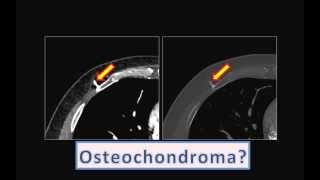 RADIOLOGY BITS (QUICK CASE 4 - ANSWER TO 1st CHALLENGE)