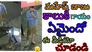 Mahesh babu's leg wounded on the sets of bharath ane nenu