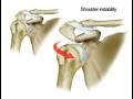 Surgical Options for Shoulder Instability - Armand Hatzidakis, MD