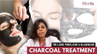 Carbon Laser Facial Treatment for Skin Glow | Elixify | Tamil