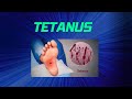 Tetanus