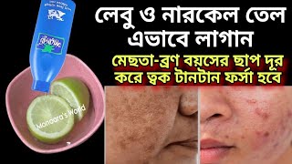 রাতে ঘুমানোর আগে লেবু ও নারকেল তেল এভাবে লাগান/মেছতা-ব্রণ বয়সের ছাপ দূর করে ত্বক টানটান ফর্সা হবে