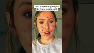 #pov you get a pimple everytime he talks to another girl #viral #story