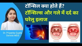 टॉन्सिल्स क्या होते हैं टॉन्सिलाइटिस और गले में दर्द का घरेलू इलाज।tonsillitis