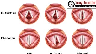 Why do Voices Squeak During Puberty?