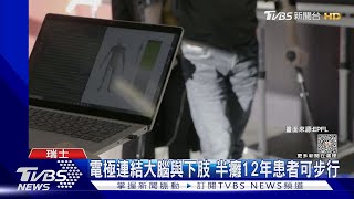 電極「開通」神經! 下肢癱瘓12年 病患可自力爬樓梯｜TVBS新聞 @TVBSNEWS01