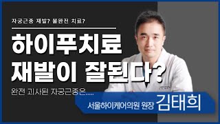 5분 순삭) 자궁근종! 하이푸치료는 재발한다??