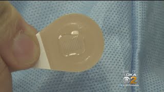 Researchers Testing Flu Vaccine Patch