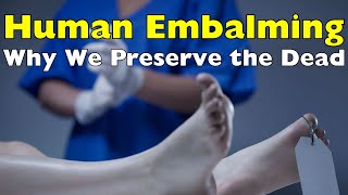 A Final Act of Care: The Compassionate Art of Human Embalming